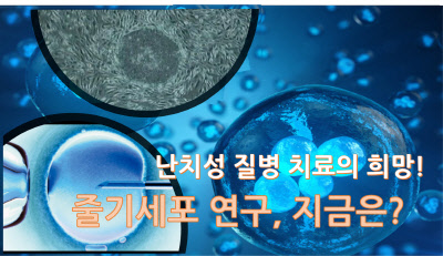 난치성 질병 치료의 희망! 줄기세포 연구, 지금은?